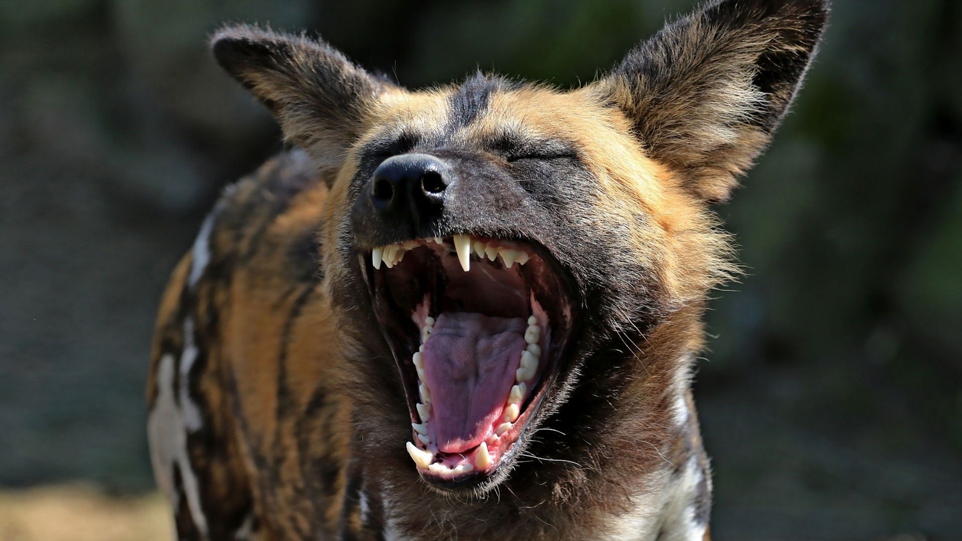 Mamak'ta Köpek Sürüsü Saldırısı: Can Havliyle Kaçarken Kolunu Kıran Yasin Arslantaş'ın Acı Hikayesi ve Topluma Yansıyan Sessiz Çığlık